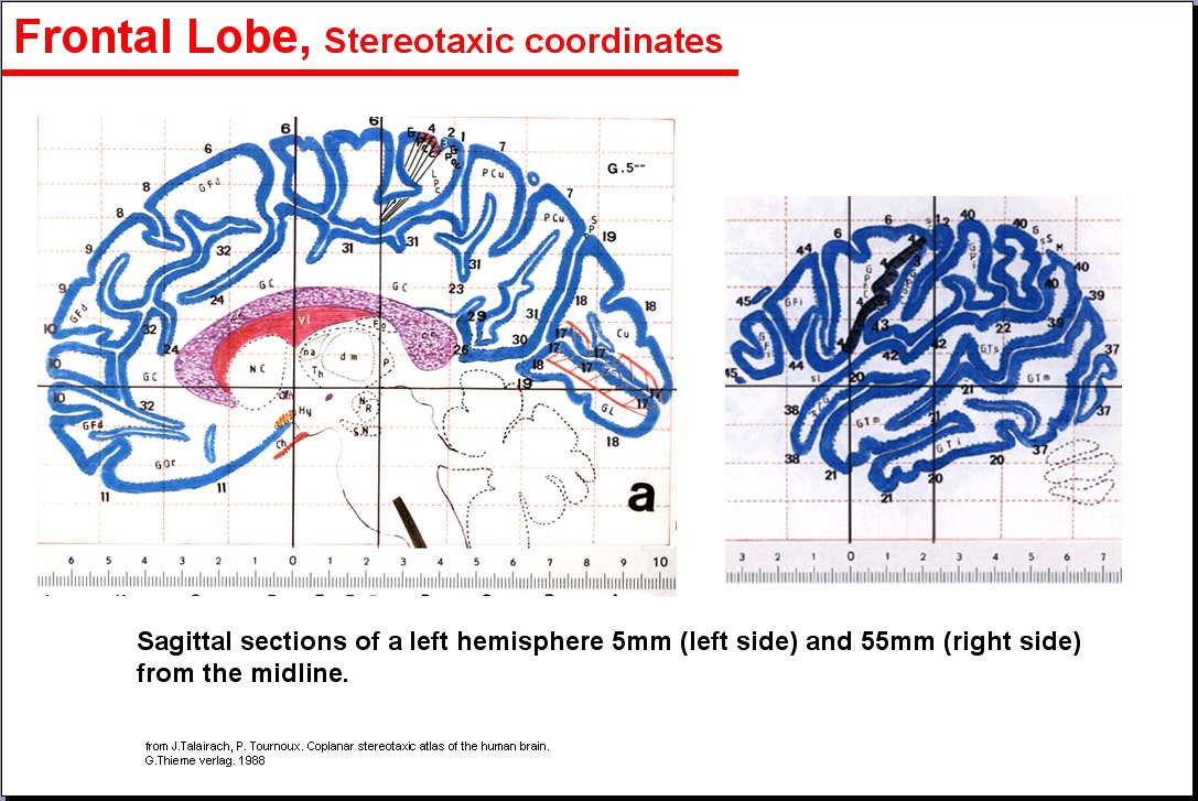 Salamons Neuroanatomy And Neurovasculature Web Atlas Resource